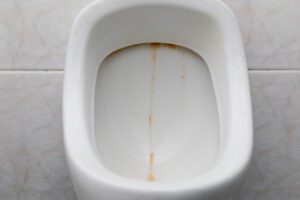 A dirty urinal with built up urine, uric scale and uric acid crystals. 